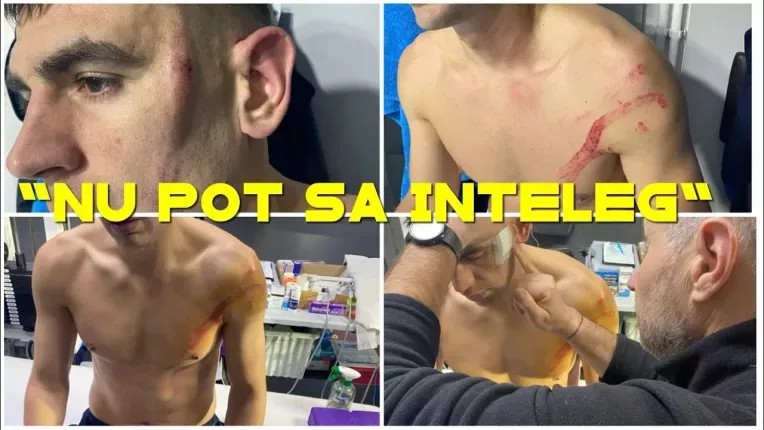 "Cartonas rosu pentru fault grosolan! Nu pot sa-mi explic". Cum arata "victima" lui Edjouma